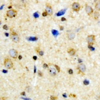 KCNJ11 / Kir6.2 Antibody - Immunohistochemical analysis of Kir6.2 (pT224) staining in human brain formalin fixed paraffin embedded tissue section. The section was pre-treated using heat mediated antigen retrieval with sodium citrate buffer (pH 6.0). The section was then incubated with the antibody at room temperature and detected using an HRP conjugated compact polymer system. DAB was used as the chromogen. The section was then counterstained with haematoxylin and mounted with DPX.