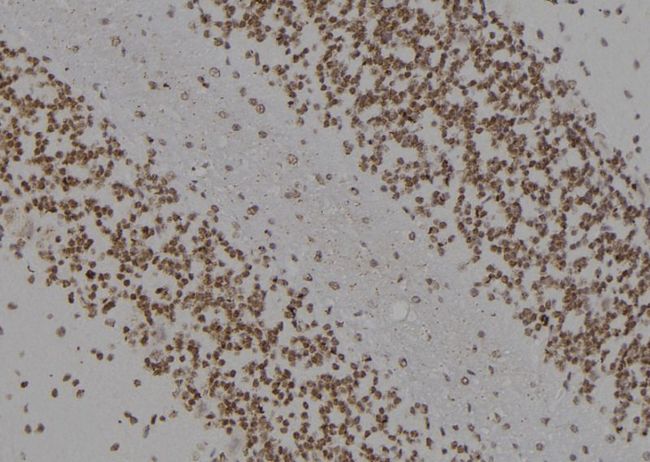 KCNJ11 / Kir6.2 Antibody - 1:100 staining rat brain tissue by IHC-P. The sample was formaldehyde fixed and a heat mediated antigen retrieval step in citrate buffer was performed. The sample was then blocked and incubated with the antibody for 1.5 hours at 22°C. An HRP conjugated goat anti-rabbit antibody was used as the secondary.