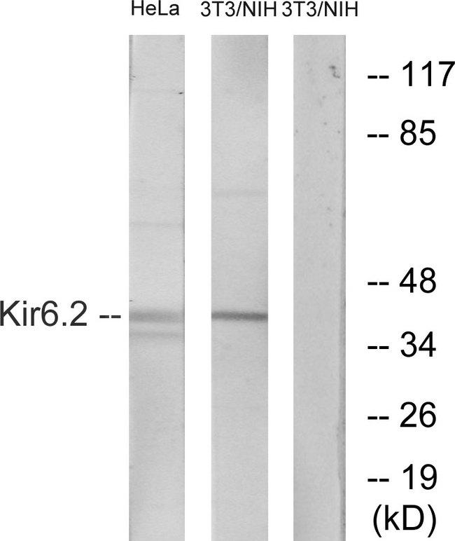 KCNJ11 / Kir6.2 Antibody - Western blot analysis of extracts from HeLa cells and NIH-3T3 cells, treated with heat shock, using Kir6.2 (Ab-224) antibody.