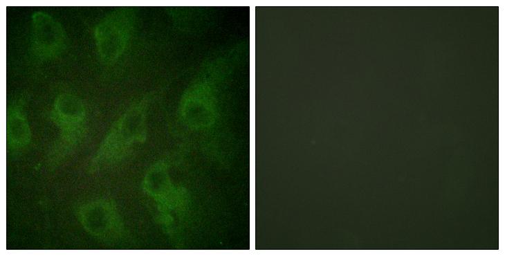 KCNJ11 / Kir6.2 Antibody - Peptide - + Immunofluorescence analysis of HeLa cells, using Kir6.2 (Ab-224) antibody.