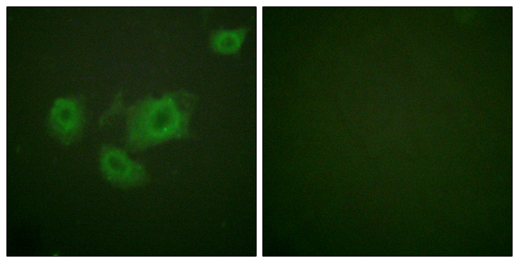 KCNJ11 / Kir6.2 Antibody - Immunofluorescence analysis of HUVEC cells, using Kir6.2 (Phospho-Thr224) Antibody. The picture on the right is blocked with the phospho peptide.