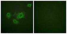 KCNJ11 / Kir6.2 Antibody - Immunofluorescence analysis of HUVEC cells, using Kir6.2 (Phospho-Thr224) Antibody. The picture on the right is blocked with the phospho peptide.