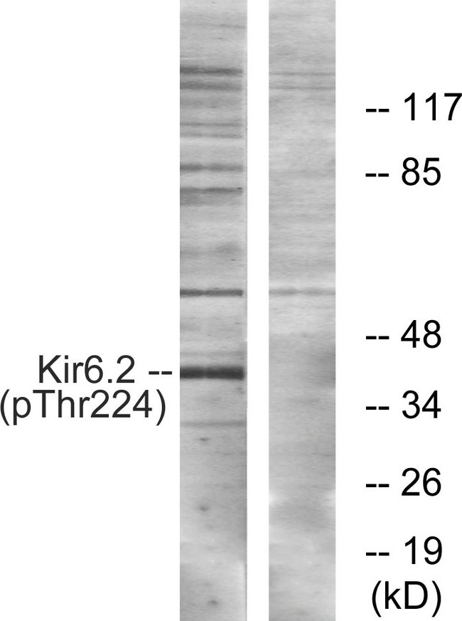 KCNJ11 / Kir6.2 Antibody - Western blot analysis of lysates from HeLa cells, using Kir6.2 (Phospho-Thr224) Antibody. The lane on the right is blocked with the phospho peptide.