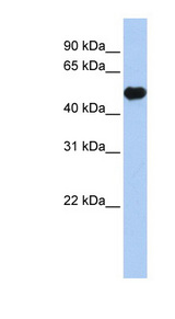 KCNJ12 / Kir2.2 Antibody - KCNJ12 / Kir2.2 antibody western blot of Fetal Brain lysate.  This image was taken for the unconjugated form of this product. Other forms have not been tested.