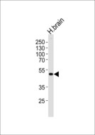 KCNJ12 / Kir2.2 Antibody - Western blot of lysate from human brain tissue lysate, using KCNJ12 Antibody. Antibody was diluted at 1:1000 at each lane. A goat anti-rabbit IgG H&L (HRP) at 1:5000 dilution was used as the secondary antibody. Lysate at 35ug per lane.
