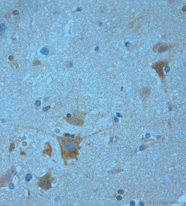 KCNJ13 / KIR7.1 Antibody - Rabbit antibody to KCNJ13 (2-50). IHC-P on paraffin sections of human brain. HIER: Tris-EDTA, pH 9 for 20 min using Thermo PT Module. Blocking: 0.2% LFDM in TBST filtered through a 0.2 micron filter. Detection was done using Novolink HRP polymer from Leica following manufacturers instructions. Primary antibody: dilution 1:1000, incubated 30 min at RT (using Autostainer). Sections were counterstained with Harris Hematoxylin.