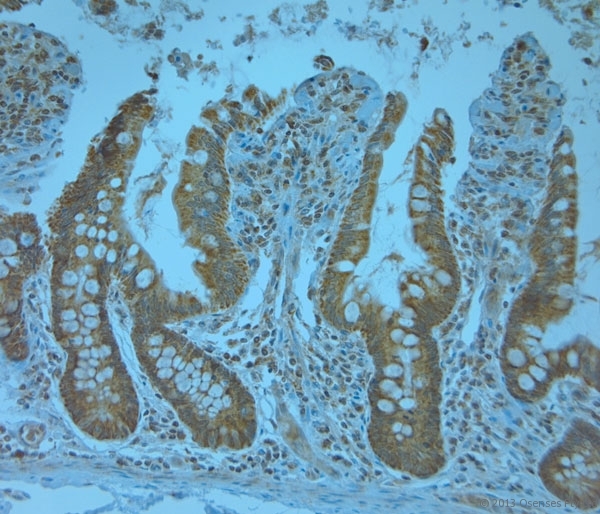 KCNJ13 / KIR7.1 Antibody - Rabbit antibody to KCNJ13 (2-50). IHC-P on paraffin sections of human small intestine. HIER: Tris-EDTA, pH 9 for 20 min using Thermo PT Module. Blocking: 0.2% LFDM in TBST filtered through a 0.2 micron filter. Detection was done using Novolink HRP polymer from Leica following manufacturers instructions. Primary antibody: dilution 1:1000, incubated 30 min at RT (using Autostainer). Sections were counterstained with Harris Hematoxylin.