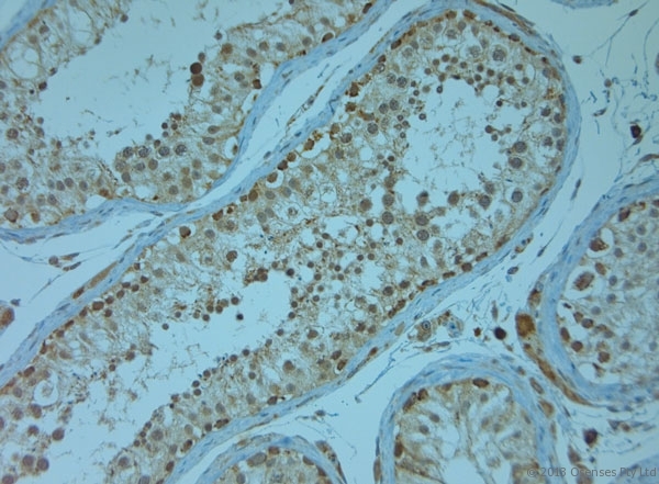 KCNJ13 / KIR7.1 Antibody - Rabbit antibody to KCNJ13 (2-50). IHC-P on paraffin sections of human testis. HIER: Tris-EDTA, pH 9 for 20 min using Thermo PT Module. Blocking: 0.2% LFDM in TBST filtered through a 0.2 micron filter. Detection was done using Novolink HRP polymer from Leica following manufacturers instructions. Primary antibody: dilution 1:1000, incubated 30 min at RT (using Autostainer). Sections were counterstained with Harris Hematoxylin.