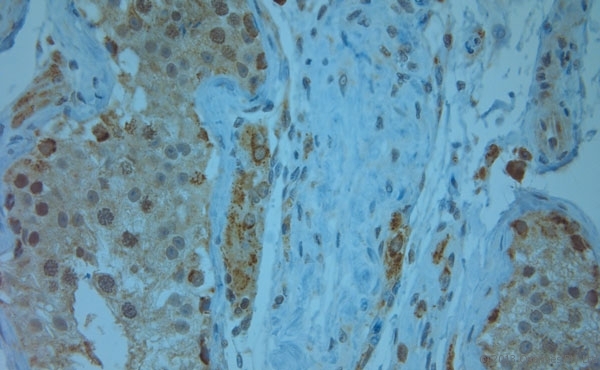 KCNJ13 / KIR7.1 Antibody - Rabbit antibody to KCNJ13 (2-50). IHC-P on paraffin sections of human testis. HIER: Tris-EDTA, pH 9 for 20 min using Thermo PT Module. Blocking: 0.2% LFDM in TBST filtered through a 0.2 micron filter. Detection was done using Novolink HRP polymer from Leica following manufacturers instructions. Primary antibody: dilution 1:1000, incubated 30 min at RT (using Autostainer). Sections were counterstained with Harris Hematoxylin.
