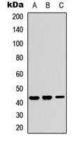 KCNJ15 / KIR4.2 Antibody - Western blot analysis of Kir4.2 expression in A549 (A); NS-1 (B); PC12 (C) whole cell lysates.