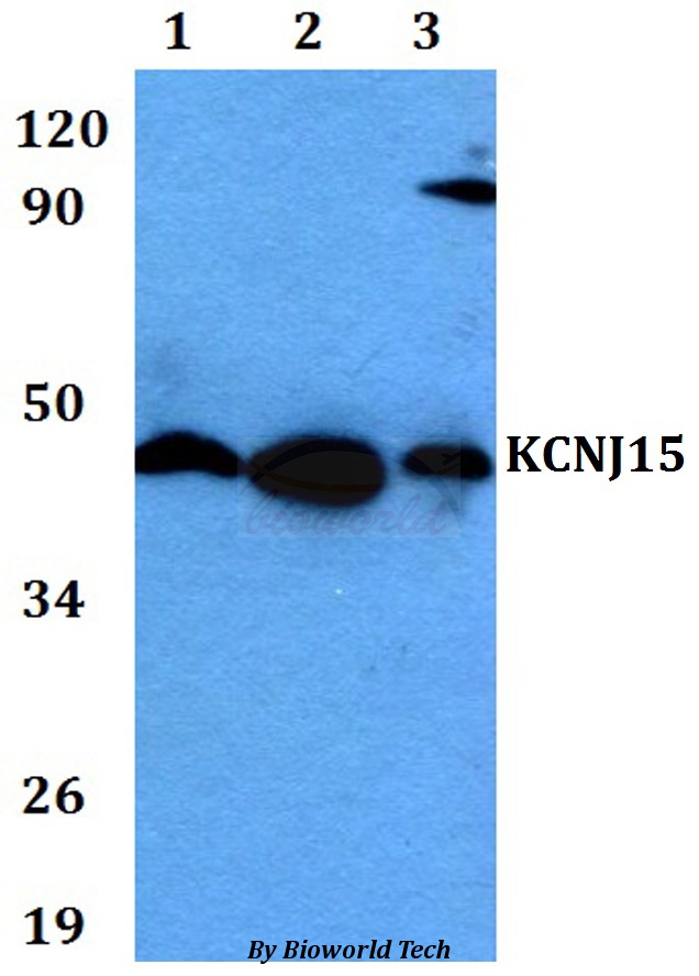 KCNJ15 / KIR4.2 Antibody - Western blot of KCNJ15 antibody at 1:500 dilution. Lane 1: A549 whole cell lysate. Lane 2: sp2/0 whole cell lysate. Lane 3: PC12 whole cell lysate.