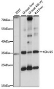 KCNJ15 / KIR4.2 Antibody - Western blot analysis of extracts of various cell lines, using KCNJ15 antibody at 1:1000 dilution. The secondary antibody used was an HRP Goat Anti-Rabbit IgG (H+L) at 1:10000 dilution. Lysates were loaded 25ug per lane and 3% nonfat dry milk in TBST was used for blocking. An ECL Kit was used for detection and the exposure time was 1s.