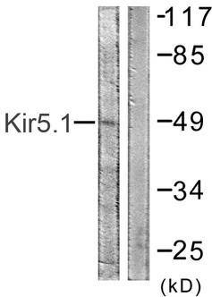 KCNJ16 / Kir5.1 Antibody - Western blot analysis of extracts from HeLa cells, using Kir5.1 (Ab-416) antibody.
