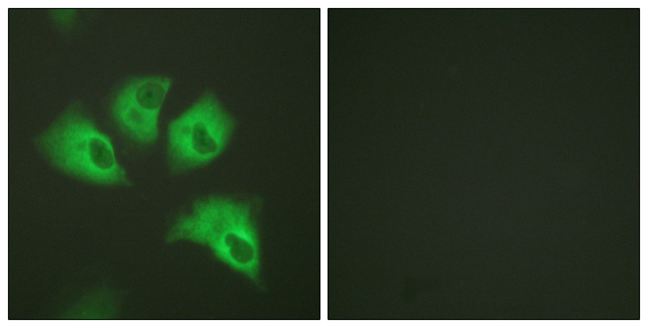 KCNJ16 / Kir5.1 Antibody - Immunofluorescence analysis of HeLa cells, using Kir5.1 (Phospho-Ser417) Antibody. The picture on the right is blocked with the phospho peptide.