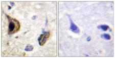 KCNJ16 / Kir5.1 Antibody - Immunohistochemistry analysis of paraffin-embedded human brain, using Kir5.1 (Phospho-Ser417) Antibody. The picture on the right is blocked with the phospho peptide.