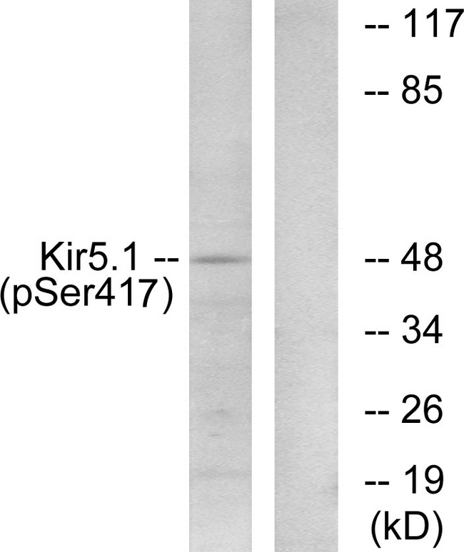 KCNJ16 / Kir5.1 Antibody - Western blot analysis of lysates from RAW264.7 cells treated with forskolin 40nM 30', using Kir5.1 (Phospho-Ser417) Antibody. The lane on the right is blocked with the phospho peptide.