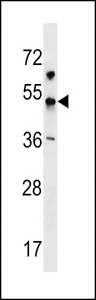 KCNJ18 Antibody - KCNJ18 Antibody western blot of NCI-H292 cell line lysates (35 ug/lane). The KCNJ18 antibody detected the KCNJ18 protein (arrow).