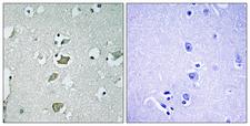 KCNJ2 / Kir2.1 Antibody - Immunohistochemistry analysis of paraffin-embedded human brain tissue, using KCNJ2 Antibody. The picture on the right is blocked with the synthesized peptide.