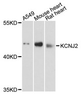 KCNJ2 / Kir2.1 Antibody - Western blot analysis of extracts of various cell lines, using KCNJ2 antibody at 1:3000 dilution. The secondary antibody used was an HRP Goat Anti-Rabbit IgG (H+L) at 1:10000 dilution. Lysates were loaded 25ug per lane and 3% nonfat dry milk in TBST was used for blocking. An ECL Kit was used for detection and the exposure time was 90s.