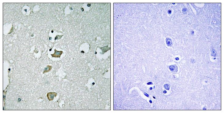 KCNJ2 / Kir2.1 Antibody - Peptide - + Immunohistochemistry analysis of paraffin-embedded human brain tissue using KCNJ2 antibody.