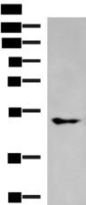KCNJ2 / Kir2.1 Antibody - Western blot analysis of A549 cell lysate  using KCNJ2 Polyclonal Antibody at dilution of 1:550