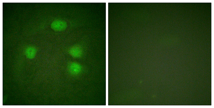 KCNJ3 / GIRK1 Antibody - Immunofluorescence analysis of HeLa cells, using GIRK1/KIR3.1/KCNJ3 Antibody. The picture on the right is blocked with the synthesized peptide.