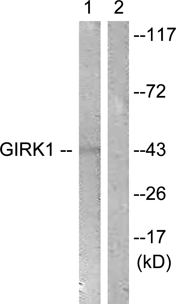 KCNJ3 / GIRK1 Antibody - Western blot analysis of lysates from NIH/3T3 cells, using GIRK1/KIR3.1/KCNJ3 Antibody. The lane on the right is blocked with the synthesized peptide.