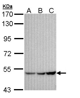 KCNJ3 / GIRK1 Antibody - Sample (30 ug of whole cell lysate). A: A431 , B: H1299, C: Hela. 7.5% SDS PAGE. KCNJ3 / GIRK1 antibody diluted at 1:1000.