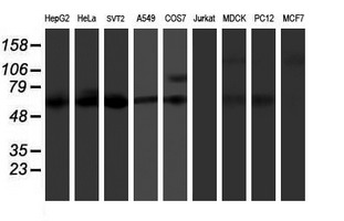 KCNJ3 / GIRK1 Antibody - Western blot of extracts (35ug) from 9 different cell lines by using anti-KCNJ3 monoclonal antibody.