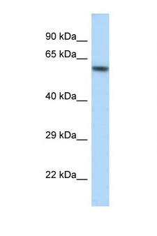 KCNJ3 / GIRK1 Antibody - KCNJ3 / Kir3.1 antibody Western blot of Mouse Kidney lysate. Antibody concentration 1 ug/ml.  This image was taken for the unconjugated form of this product. Other forms have not been tested.