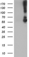 KCNJ3 / GIRK1 Antibody - HEK293T cells were transfected with the pCMV6-ENTRY control (Left lane) or pCMV6-ENTRY KCNJ3 (Right lane) cDNA for 48 hrs and lysed. Equivalent amounts of cell lysates (5 ug per lane) were separated by SDS-PAGE and immunoblotted with anti-KCNJ3.