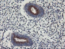 KCNJ3 / GIRK1 Antibody - IHC of paraffin-embedded Human endometrium tissue using anti-KCNJ3 mouse monoclonal antibody.
