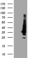 KCNJ3 / GIRK1 Antibody - HEK293T cells were transfected with the pCMV6-ENTRY control (Left lane) or pCMV6-ENTRY KCNJ3 (Right lane) cDNA for 48 hrs and lysed. Equivalent amounts of cell lysates (5 ug per lane) were separated by SDS-PAGE and immunoblotted with anti-KCNJ3.