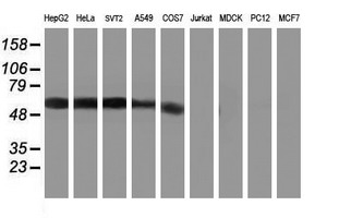 KCNJ3 / GIRK1 Antibody - Western blot of extracts (35 ug) from 9 different cell lines by using anti-KCNJ3 monoclonal antibody.