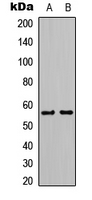 KCNJ3 / GIRK1 Antibody - Western blot analysis of Kir3.1 expression in K562 (A); NIH-3T3 (B) whole cell lysates.
