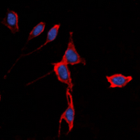 KCNJ3 / GIRK1 Antibody - Immunofluorescent analysis of Kir3.1 staining in K562 cells. Formalin-fixed cells were permeabilized with 0.1% Triton X-100 in TBS for 5-10 minutes and blocked with 3% BSA-PBS for 30 minutes at room temperature. Cells were probed with the primary antibody in 3% BSA-PBS and incubated overnight at 4 deg C in a humidified chamber. Cells were washed with PBST and incubated with a DyLight 594-conjugated secondary antibody (red) in PBS at room temperature in the dark. DAPI was used to stain the cell nuclei (blue).