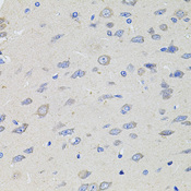 KCNJ3 / GIRK1 Antibody - Immunohistochemistry of paraffin-embedded rat brain tissue.