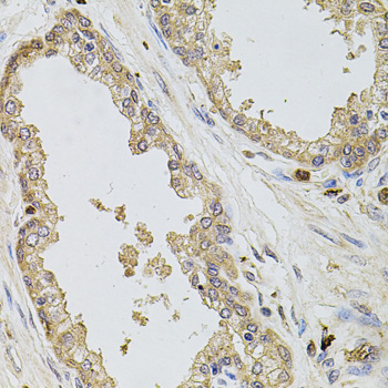 KCNJ3 / GIRK1 Antibody - Immunohistochemistry of paraffin-embedded human prostate tissue.