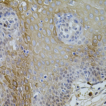 KCNJ3 / GIRK1 Antibody - Immunohistochemistry of paraffin-embedded human esophagus tissue.