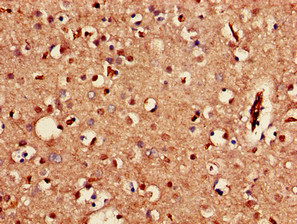 KCNJ3 / GIRK1 Antibody - Immunohistochemistry of paraffin-embedded human brain tissue using KCNJ3 Antibody at dilution of 1:100