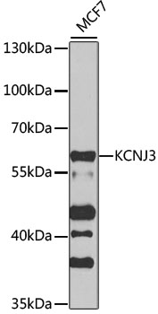 KCNJ3 / GIRK1 Antibody - Western blot analysis of extracts of MCF7 cells, using KCNJ3 antibody at 1:1000 dilution. The secondary antibody used was an HRP Goat Anti-Rabbit IgG (H+L) at 1:10000 dilution. Lysates were loaded 25ug per lane and 3% nonfat dry milk in TBST was used for blocking. An ECL Kit was used for detection and the exposure time was 20s.