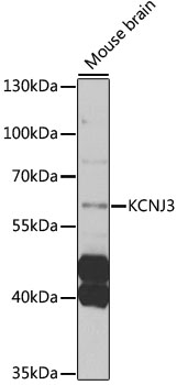 KCNJ3 / GIRK1 Antibody - Western blot analysis of extracts of mouse brain, using KCNJ3 antibody at 1:1000 dilution. The secondary antibody used was an HRP Goat Anti-Rabbit IgG (H+L) at 1:10000 dilution. Lysates were loaded 25ug per lane and 3% nonfat dry milk in TBST was used for blocking. An ECL Kit was used for detection and the exposure time was 10s.