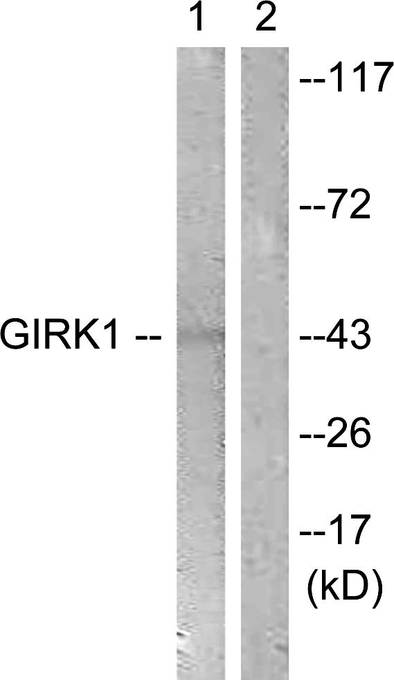 KCNJ3 / GIRK1 Antibody - Western blot analysis of extracts from NIH/3T3 cells, using GIRK1/KIR3.1/KCNJ3 (Ab-185) antibody.