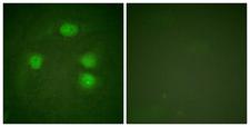 KCNJ3 / GIRK1 Antibody - Peptide - + Immunofluorescence analysis of HeLa cells, using GIRK1/KIR3.1/KCNJ3 (Ab-185) antibody.