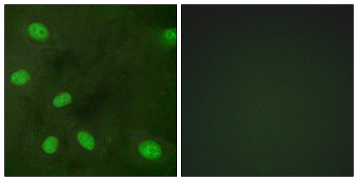 KCNJ3 / GIRK1 Antibody - Immunofluorescence analysis of HeLa cells, using GIRK1/KIR3.1/KCNJ3 (Phospho-Ser185) Antibody. The picture on the right is blocked with the phospho peptide.