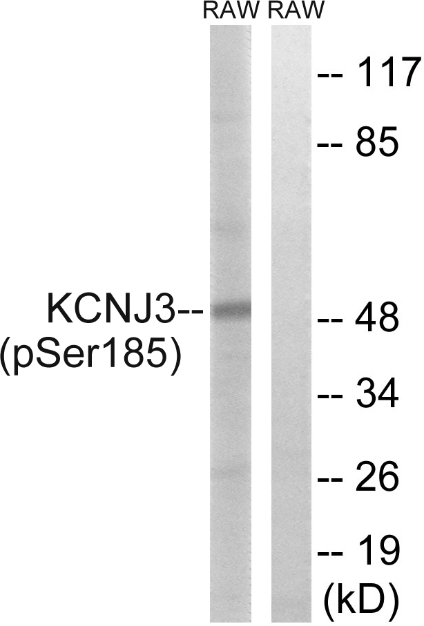 KCNJ3 / GIRK1 Antibody - Western blot analysis of lysates from RAW264.7 cells treated with Insulin 0.01U/ml 15', using GIRK1/KIR3.1/KCNJ3 (Phospho-Ser185) Antibody. The lane on the right is blocked with the phospho peptide.