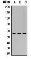 KCNJ3 / GIRK1 Antibody - Western blot analysis of Kir3.1 (pS185) expression in A549 (A); Raw264.7 (B); COS7 (C) whole cell lysates.