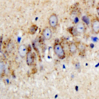KCNJ3 / GIRK1 Antibody - Immunohistochemical analysis of Kir3.1 (pS185) staining in human brain formalin fixed paraffin embedded tissue section. The section was pre-treated using heat mediated antigen retrieval with sodium citrate buffer (pH 6.0). The section was then incubated with the antibody at room temperature and detected using an HRP conjugated compact polymer system. DAB was used as the chromogen. The section was then counterstained with hematoxylin and mounted with DPX.