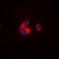 KCNJ3 / GIRK1 Antibody - Immunofluorescent analysis of Kir3.1 (pS185) staining in A549 cells. Formalin-fixed cells were permeabilized with 0.1% Triton X-100 in TBS for 5-10 minutes and blocked with 3% BSA-PBS for 30 minutes at room temperature. Cells were probed with the primary antibody in 3% BSA-PBS and incubated overnight at 4 deg C in a humidified chamber. Cells were washed with PBST and incubated with a DyLight 594-conjugated secondary antibody (red) in PBS at room temperature in the dark. DAPI was used to stain the cell nuclei (blue).