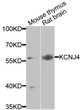 KCNJ4 / Kir2.3 Antibody - Western blot analysis of extracts of various cells.